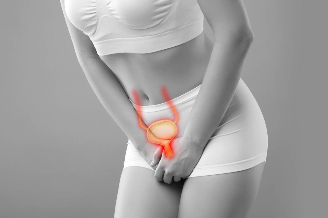 Preventing and treating urinary incontinence