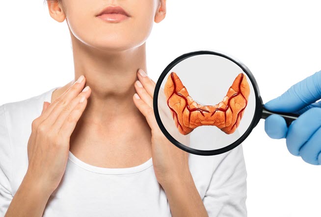 Wedding Checkup - Hypothyroidism