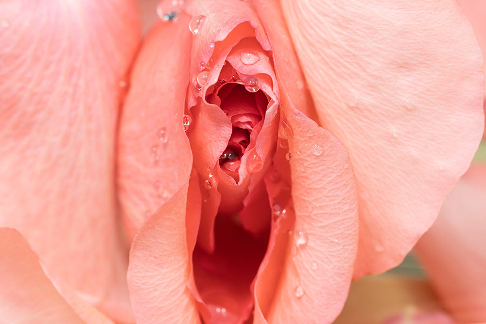 Vaginal dryness intermediate banner