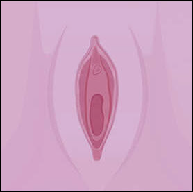 After labiaplasty surgery