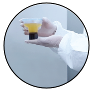 Autologous Bone Marrow Stem Cell Procedure 5