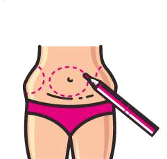 Liposuction Thread Progression 1