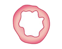 40 vaginal fillers