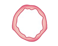50% vaginal filler