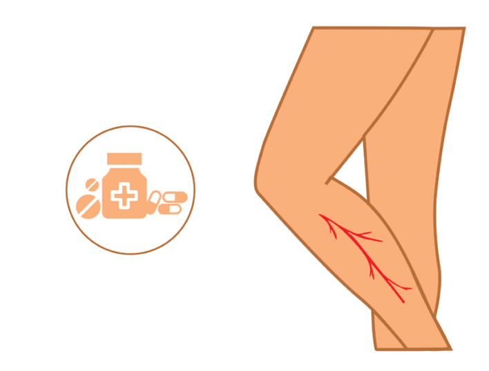 Pharmacotherapy for Venous Insufficiency