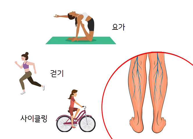Exercise Therapy for Venous Insufficiency