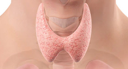 4 steps to the thyroid radiofrequency ablation procedure