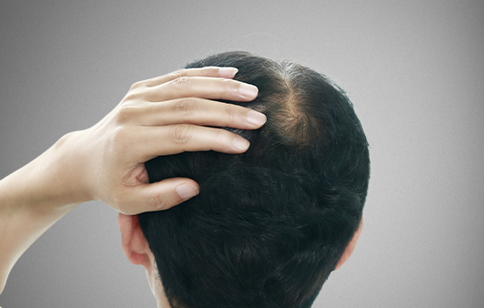 Stem Cell Therapy Effects 3