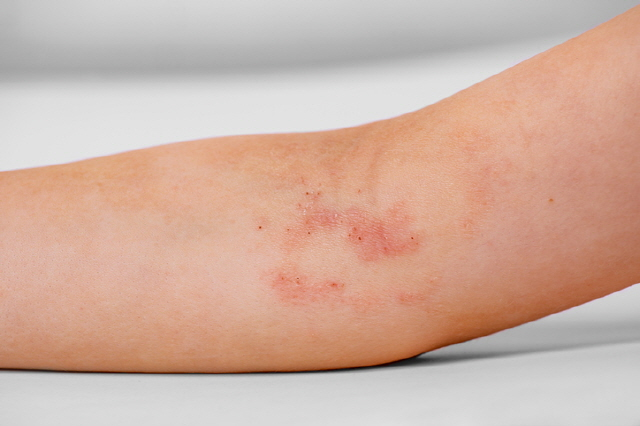Stem Cell Therapy Effects 4