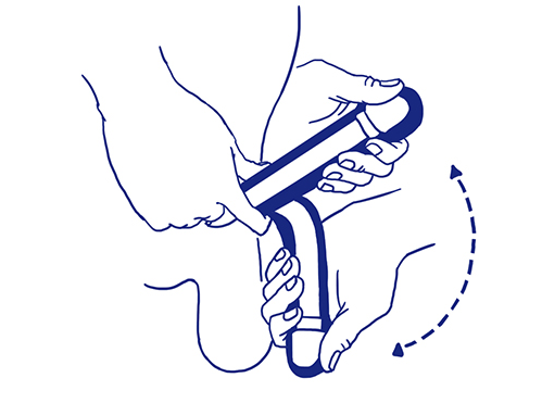 How the Malleable Penile Implant Works