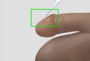 Penile Enlargement Glans Enlargement STEP 1