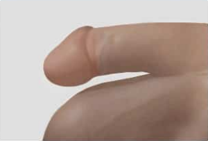 Penile Enlargement Glans Enlargement STEP 2